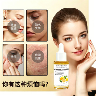 �F؛�ͷ������ �c�T���͵�����ӡ���o�������A��OEM�羳�J�C