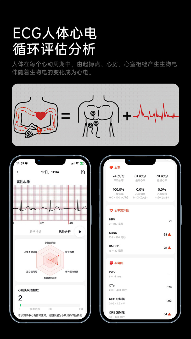 The 2025 new ET456 smartwatch features a 1.56 large AMOLED screen, ECG, Bluetooth call, heart rate and sleep mode undefined