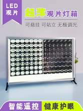 led�^Ƭ����led��Ƭ��X���Ƭ������p���ƹǿ����g��