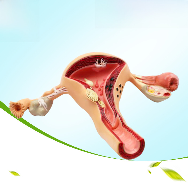 Teaching simulation of human uterine ovarian anatomy model