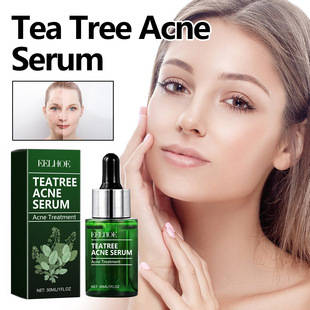 EELHOE �G�迹�����AҺ ���������۴̿�����˥���̝������wɫ