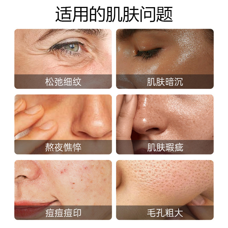 【现货】玻尿酸可溶微针滚轮促进吸收无痛水光美容院专用紧致提拉|undefined