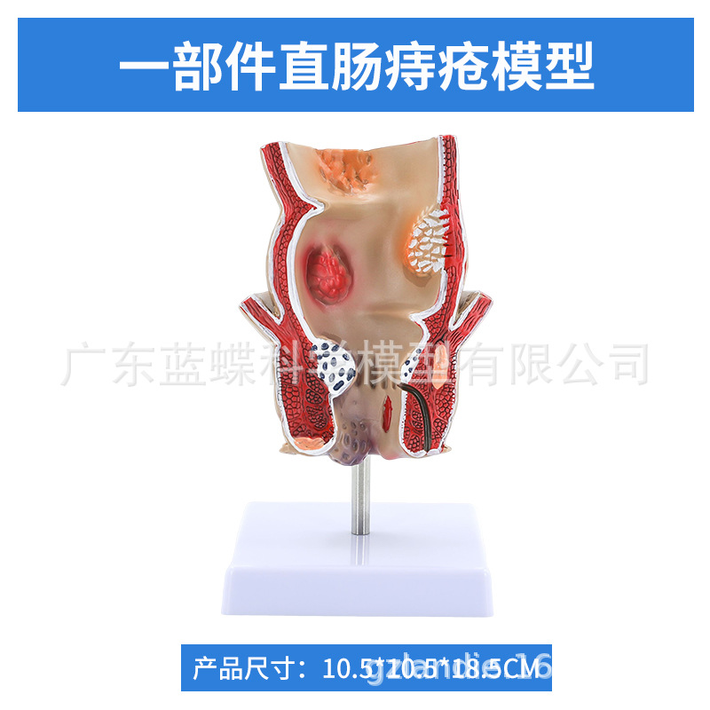 ��ѧ��������󳦲���ģ�ͳ�θֱ���̴�������ʳ��������᳦����