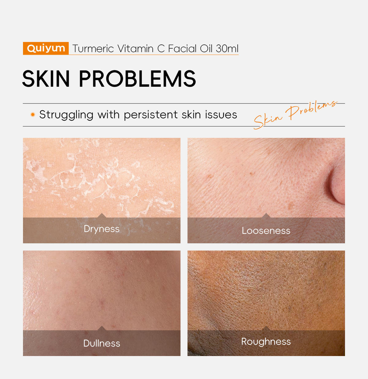 quiyum's new cross-border product, turmeric Vitamin c Facial Essence Oil 30ml, is a hydrating, moisturizing and nourishing FDA skin care product undefined