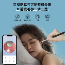 NK-5101��ҕ�ڶ����m���O��/��׿Type-c�֙Cֱ�B���R Otoscope