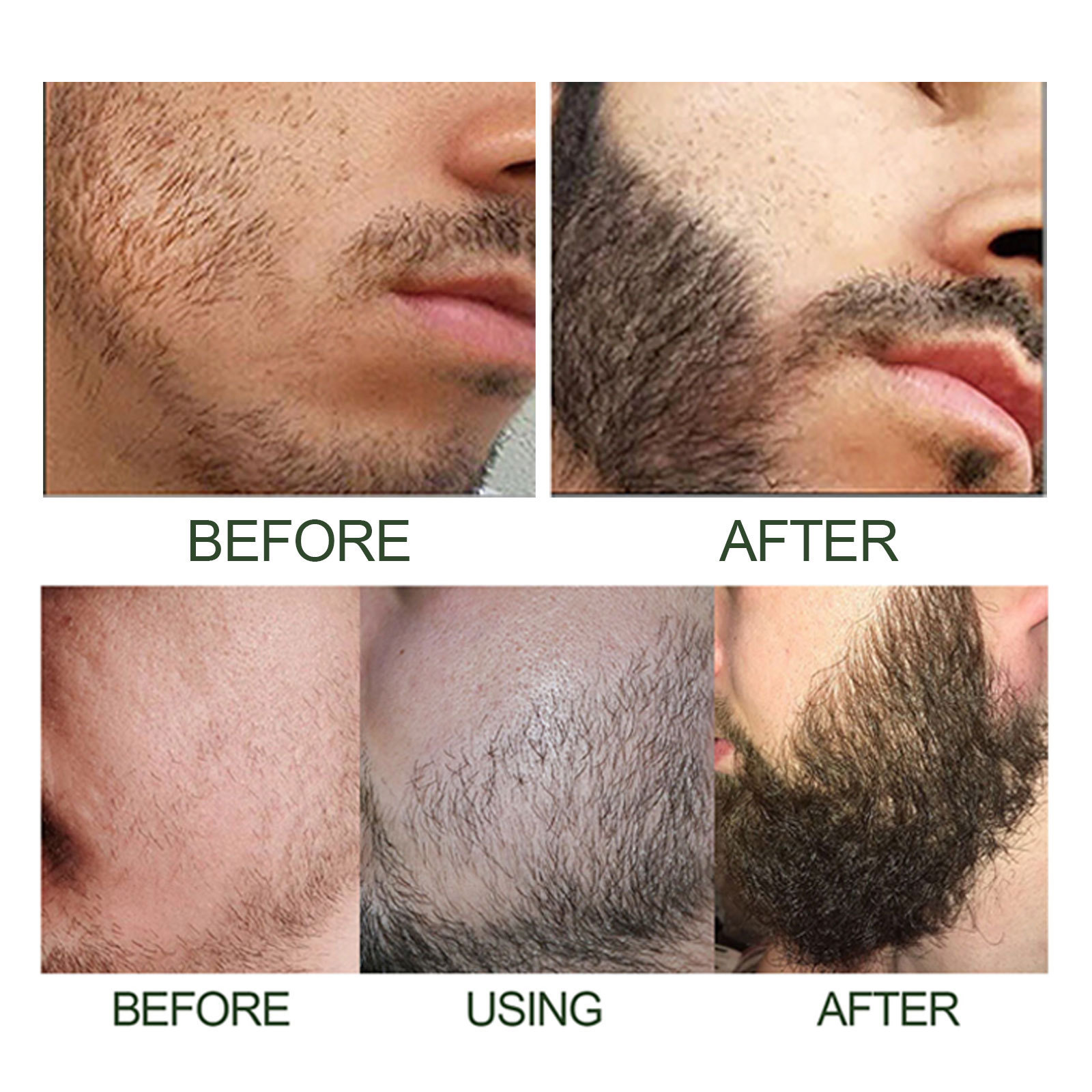 East Moon Beard Thick Serum Set, muško njegujuće ulje za njegu guste dlake na licu_voghion.com