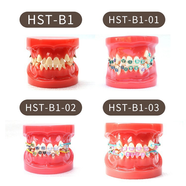 牙科正畸模型半金屬半托槽牙齒模型透明牙模矯正練習醫患溝通模型