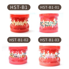 牙科正畸模型半金屬半托槽牙齒模型透明牙模矯正練習醫患溝通模型