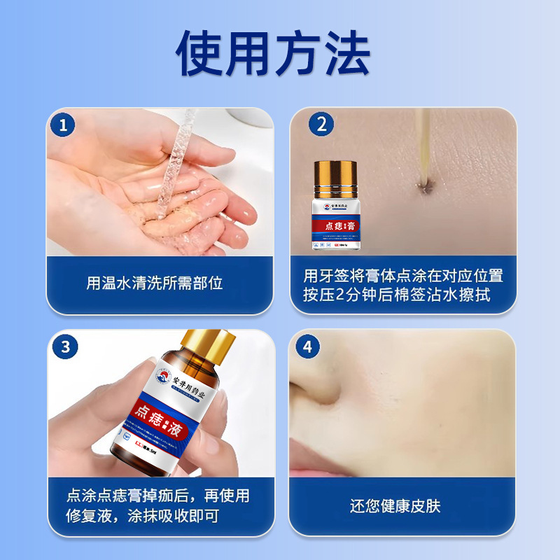 安井川药业点痣膏套盒点痣液黑痣痦子瘊子肉刺脂肪粒点痣膏点斑膏|undefined