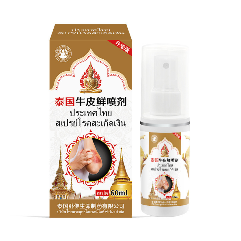 タイの臥仏の牛のコケの銀の頭の皮の白癬は菌を診察して皮膚のかゆみに感染して頑固な牛のコケのかゆみを止めますスプレー|undefined