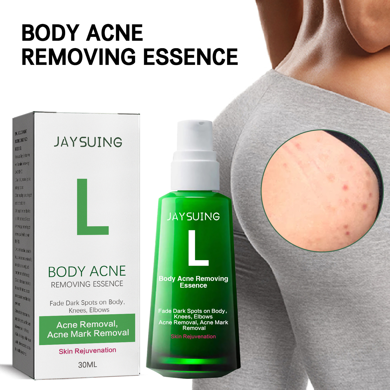 Jaysuing 痘痘煥白精華素 淡化痘痘斑點痘印滋潤煥白肌膚護膚精華