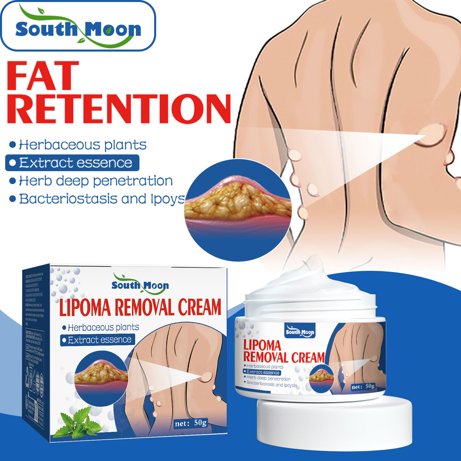 South Moon Fat Cream Relieves Fat Masses, Cough Bulges, Anti-Tumor Cream Improves Fat Nodules Cream