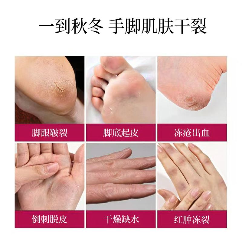 건조 방지 및 크래킹 방지 크림 보습 및 간호 발 뒤꿈치 균열 크림 가을과 겨울 손과 발 균열 진정 핸드 크림