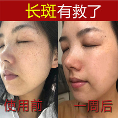 377VC斷黑霜祛淡化斑點雀斑黃褐斑抑制黑色素去暗黃美容院控色霜