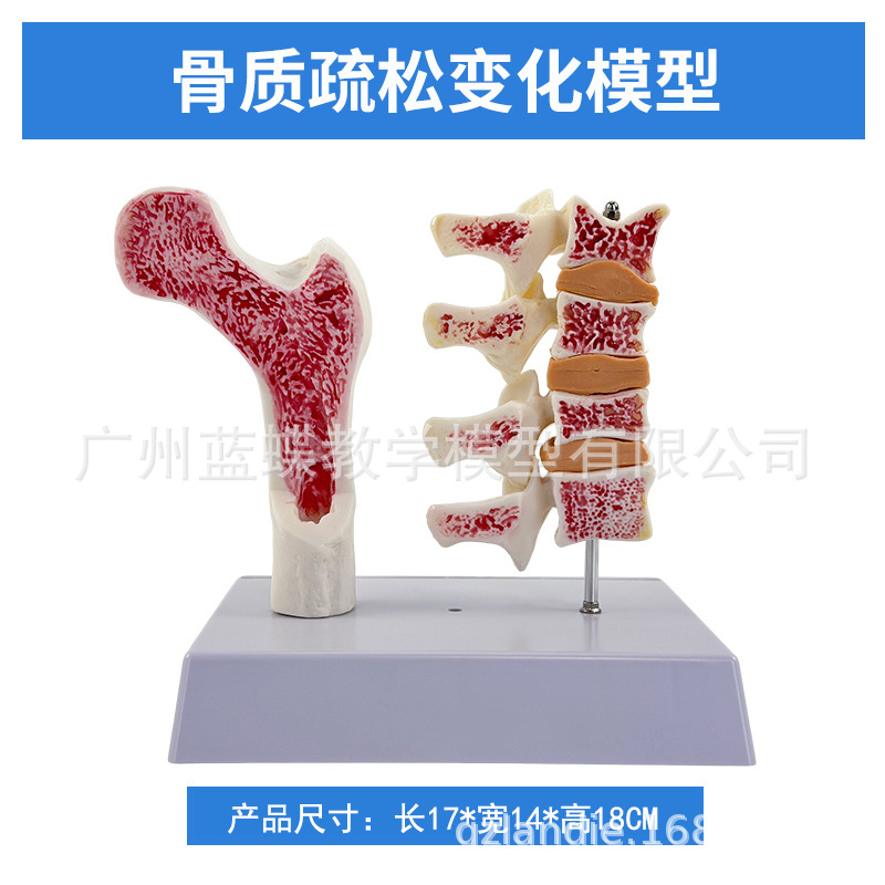 ����ɹǹ������ɽ���ģ���ȹǽ����� ��������걾 ������׵ģ��