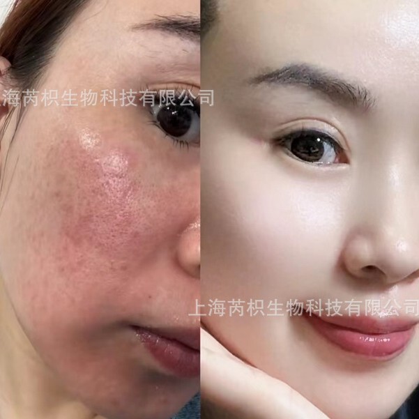 エッセンシャルオイルマスクは肌を落ち着かせ、修復し、オイルで肌に栄養を与え、ベタつきがなく、ニキビができず、乾燥肌や敏感肌に別れを告げます。|undefined