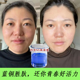 �{�~���ľ��AҺ�����o�µ������yë���沿�o�w���۰ױ����ޏ�ԭҺ