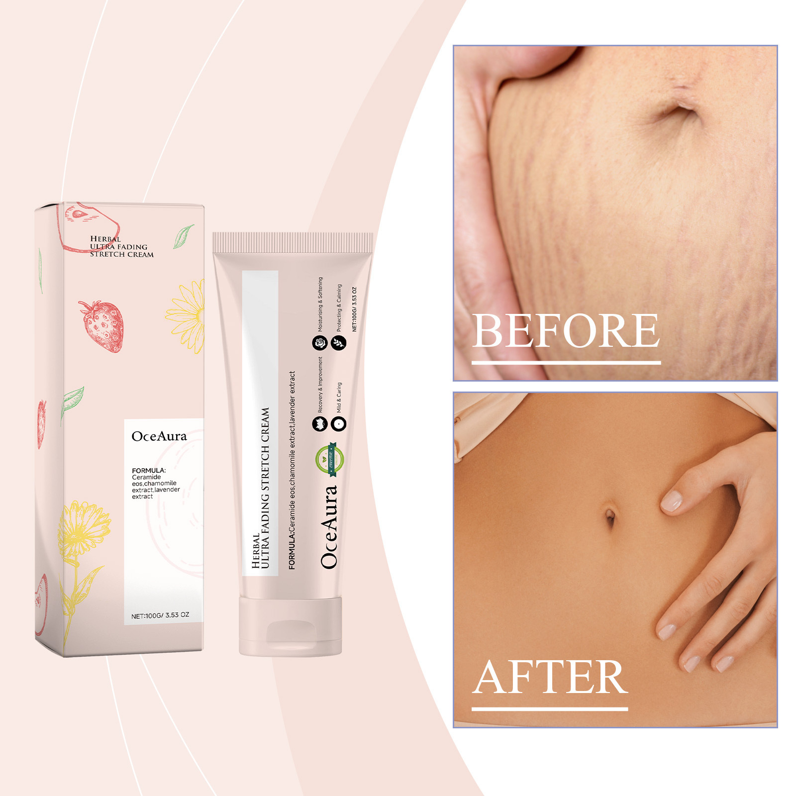 Oceaura Skin Care Cream Lighten Fat Lines Postpartum Scar Moisturizing Smooth Skin Body Care Cream