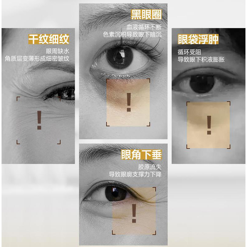 LVFEI Herbal Anti-arrugas Eye Cream Essence Plantal Calming Eye Moisturizing Measure Pigmentation Moisturizing Eye Brilliance