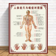 人体与病症经络大其他穴位对照拔罐图针灸跨境挂图经穴中医无纺布