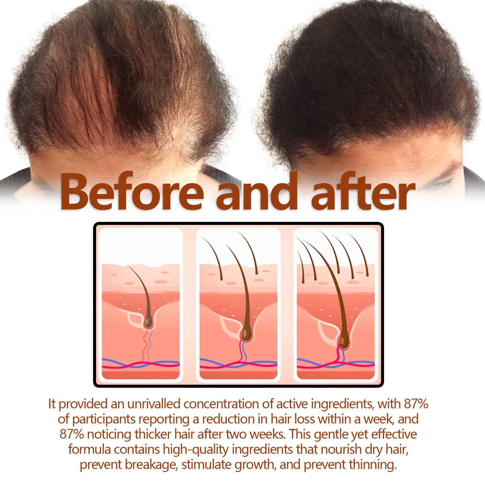 EELHOE zeliščni losjon za lase od korenin učvrsti in obnovi debelo lasno linijo, krepi lase, vlaži lase in preprečuje izpadanje las_voghion.com