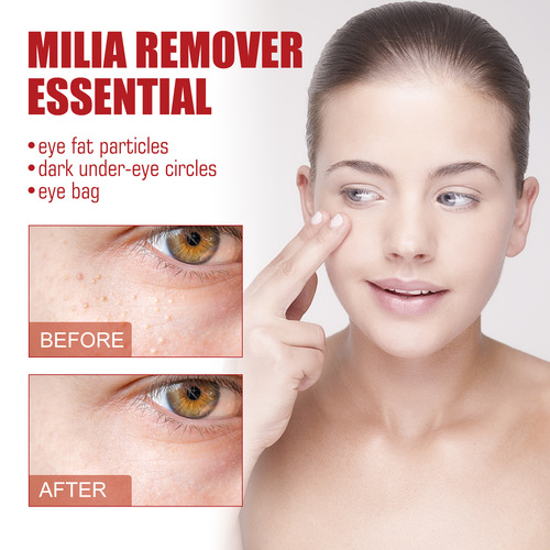 South Moon Cellulite Removing Essence Removes Eye Particles, Lifts, Diminishes Fine Lines, and Firms Eyes Essence
