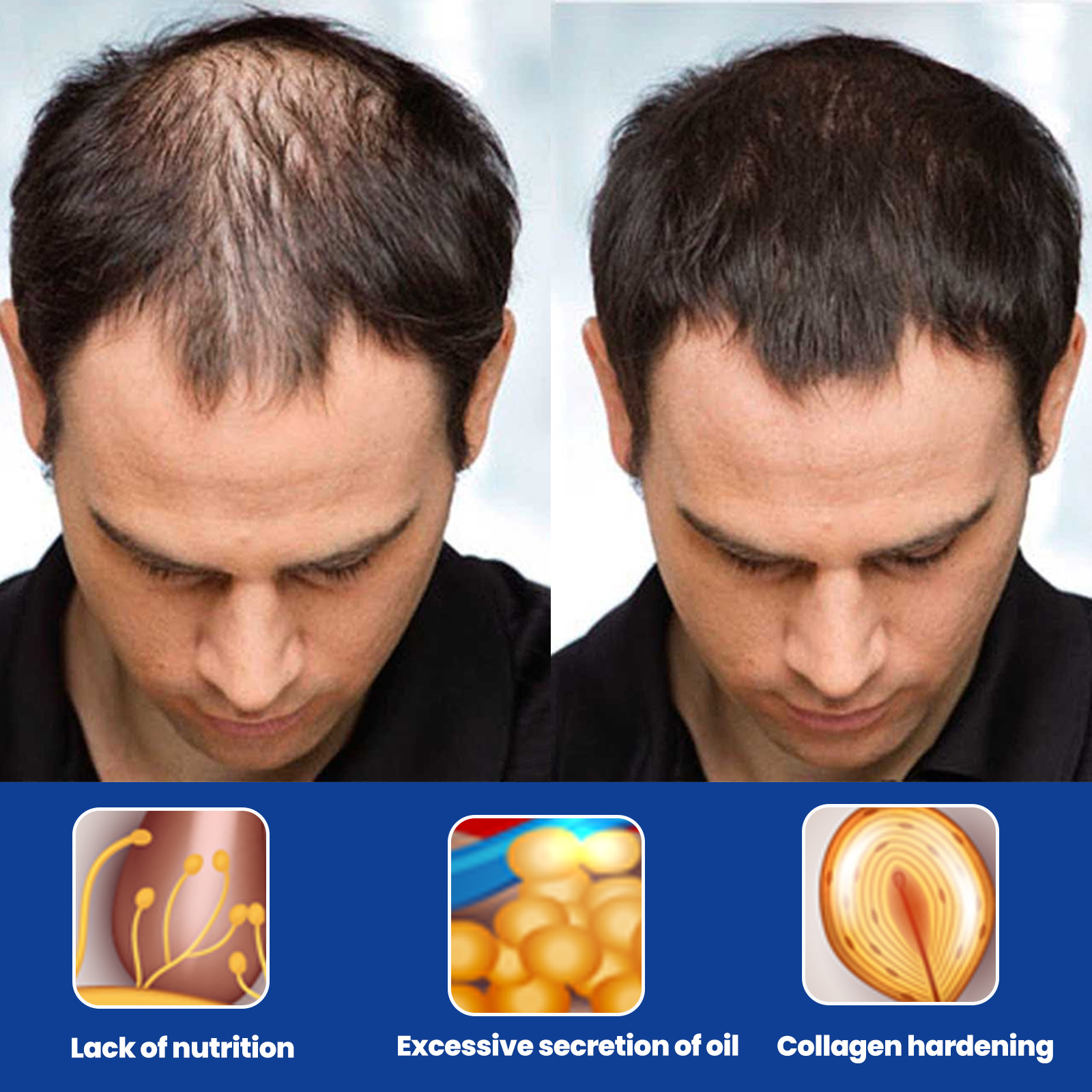 Moon Men's East foam Agent Chest Hair Beard Hairline Thick Growth Nutrition Liquid         line_voghion.com