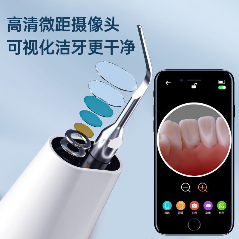 可视化HYUNDAI洁牙器洗洁牙结超去声波石除器牙垢渍清洁牙垢渍器|undefined
