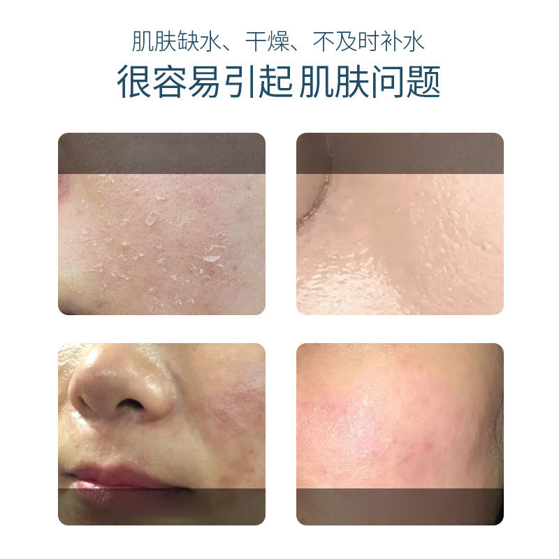 玻尿酸补水喷雾大容量舒润清爽滋润化妆水保湿精华爽肤水喷雾批发|undefined