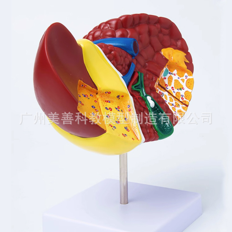 Advanced color pathological liver model