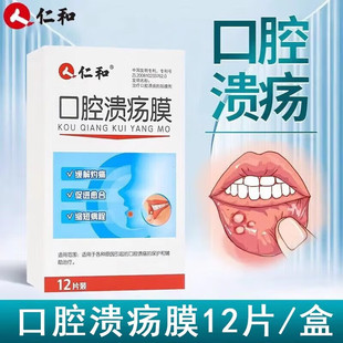 仁和 Oral ulcer membrane, mouth sores, clear heat and shortness of air, suitable for pain, mouth and tongue pain, wholesale 1 2 tablets per box