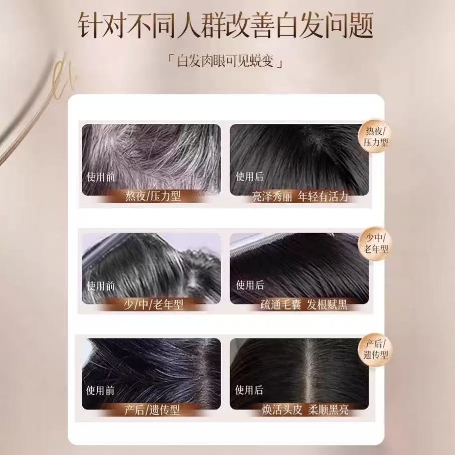 Esencia para el cuidado del cabello Ao Duo Shouwu Azafrán Suaviza e hidrata el cuero cabelludo Aceite esencial para el cuidado del cabello a base de hierbas Ventas directas de fábrica