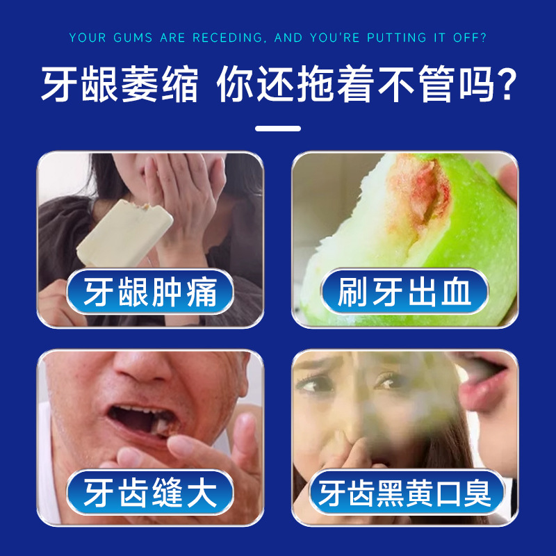 Hong Kong Big Pharmacy genuine dental separation agent gingival atrophy and loosening repair periodontal hematoma pain medical