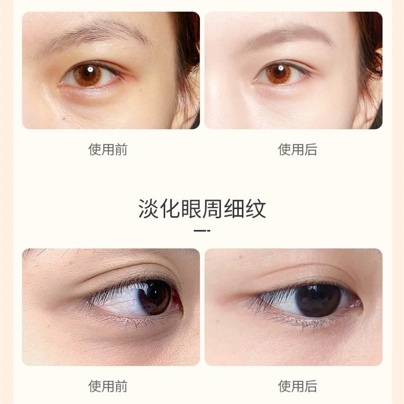 向美博士の葉黄素の目の部の薄い紋の精華の油の目の油のボールの保湿はしわに抵抗して顔の精華の目の周りを引き締めます。|undefined
