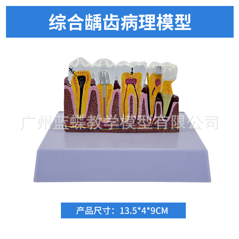 ���ƿ�ǻ�ı�ȣ�ݷֽ�ģ�� ����������ʾȣ�ݷ�չ���� ҽ����ͨ