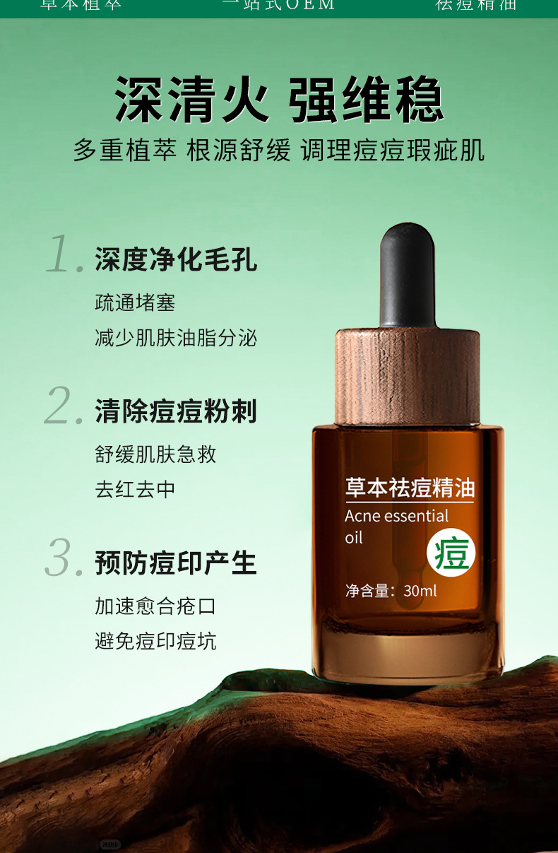 Acne Care Essential Oil Blend for Blemish-Prone Skin 15ml Topical Repair Oil in use