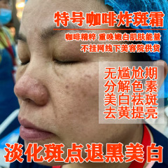 病院で人気の強力なシミ取りクリーム、美白クリーム、メラニンを分解して肌を明るくするクリーム、色調をコントロールするクリーム