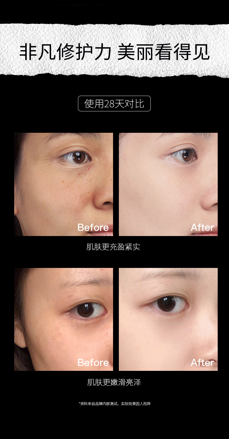5-11黑绷带面霜详情页_09.jpg