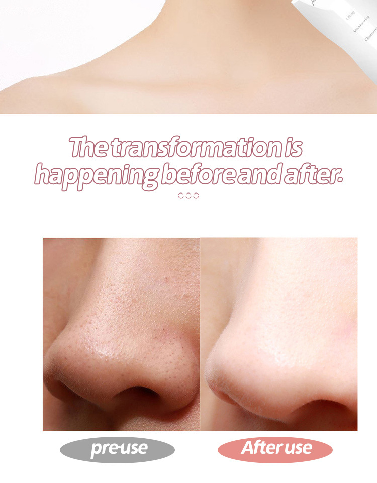 Ultrasonic Skin Scraper Image 8