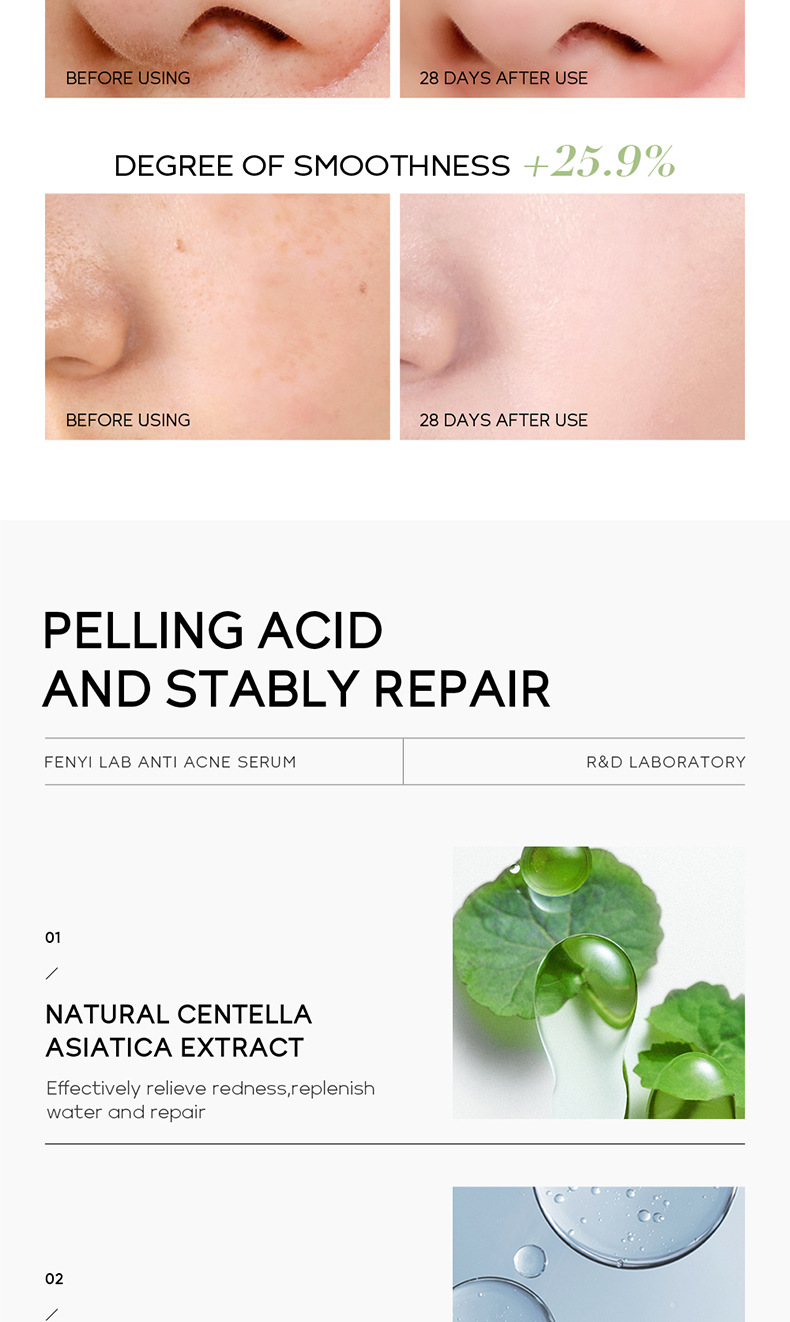 FENYI LAB Fenitol Acid Essence 17ml Facial Care Moisturizing and Hydrating Cross-border Skin Care Product undefined