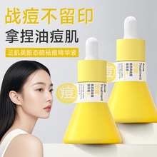 �z�B������AҺ������ӡ������o������͹���ԭҺ����AҺ