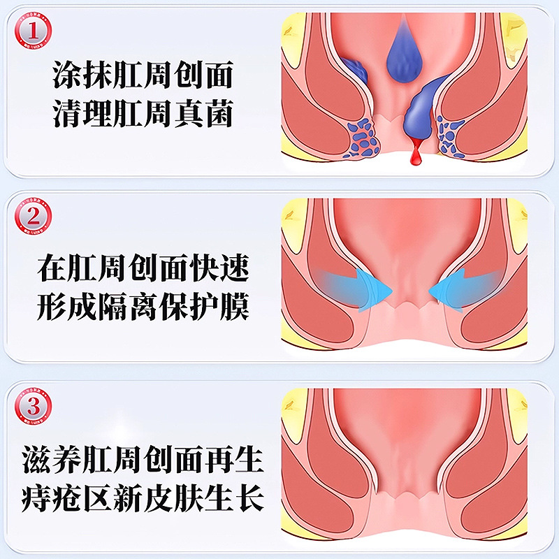 Medical Hemorrhoid Gel Soothing Antibacterial Cream 20g External Topical Care preparation