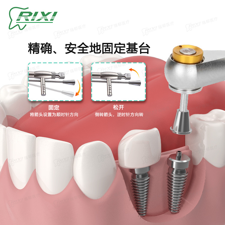 Caja de herramientas de reparación de implantes dentales para implantes orales, conjunto de herramientas de llave de torsión