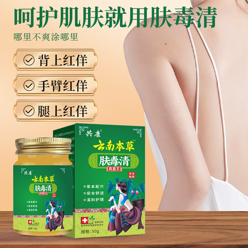 皮膚毒清健康クリーム、ハーブ配合、乾燥した全身に使用可能、卸売用かゆみ止めクリーム、外用皮膚毒清|undefined