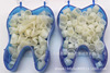 Dental material temporary crown oral porcelain teeth temporary crown crown front and rear teeth