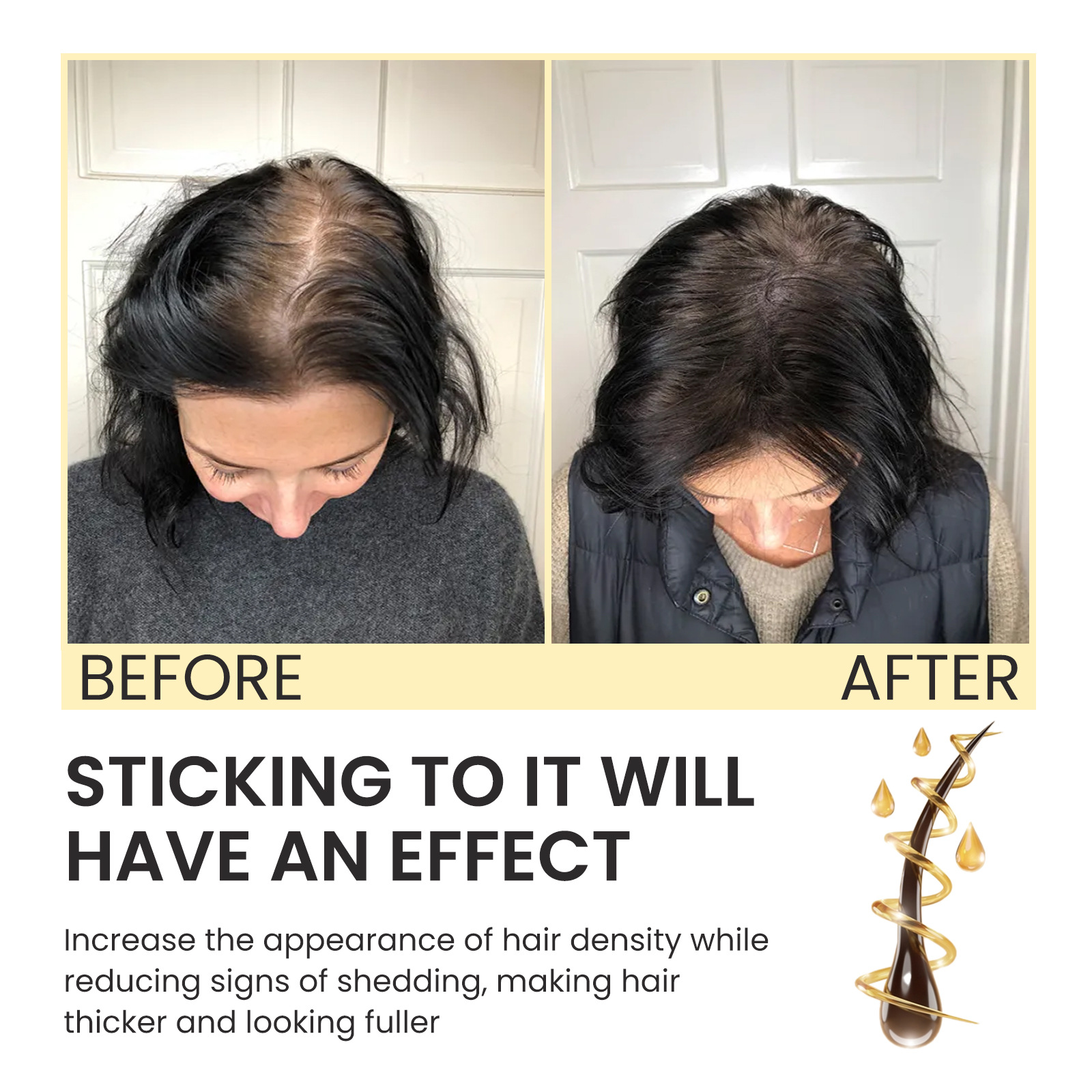 OUHOE Biotin Moisturizing Root Dense Repairing Hairline Strong and Firm Hair Essence_voghion.com