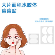 �羳����eˮ�z�w�����෶���ڶ�������ˮ�����[��͸���N��yʽ