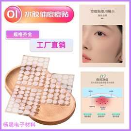 水胶体痘痘贴裸货批发 隐形遮瑕净痘防护贴