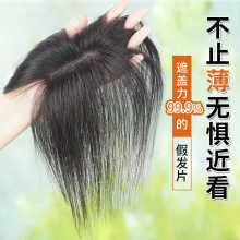 郁金香假发片头顶补发蓬松全真人发遮白发高颅顶轻薄款无痕假刘海