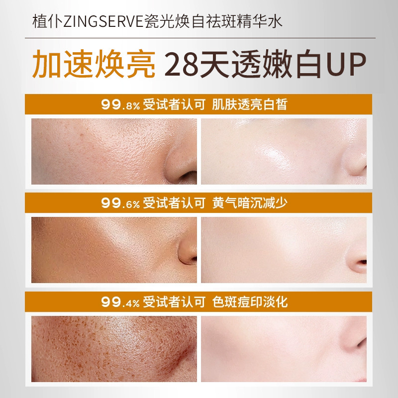 焕白祛斑精华水VC精华液面部护理美白淡斑补水保湿细嫩呵护肌肤|undefined